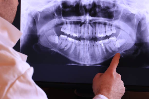 Best Weekend Emergency Dentist in Newburyport, MA