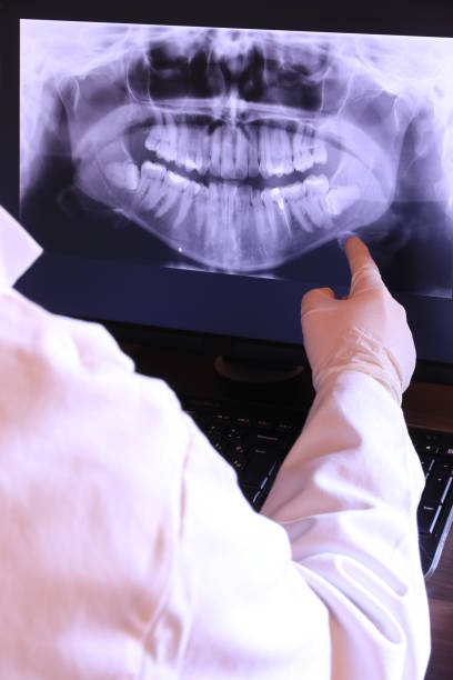 Best Emergency Wisdom Teeth Removal in Newburyport, MA