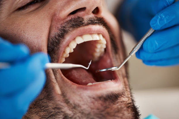 Best Emergency Broken Tooth Repair in Newburyport, MA